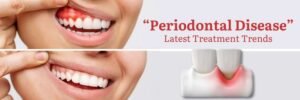 Combating Periodontal Disease